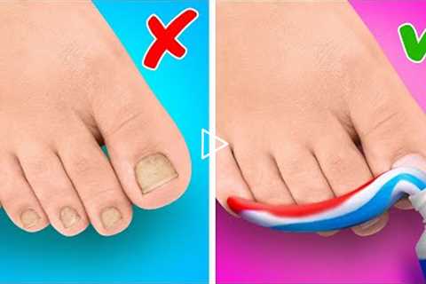 Amazing Feet Gadgets and Hacks || DIY Ideas For Your Shoes